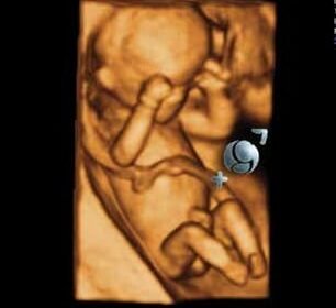 Scanova Imaging Center in Aurangabad, offering 3D sonography services by Dr. Sanket Sarda