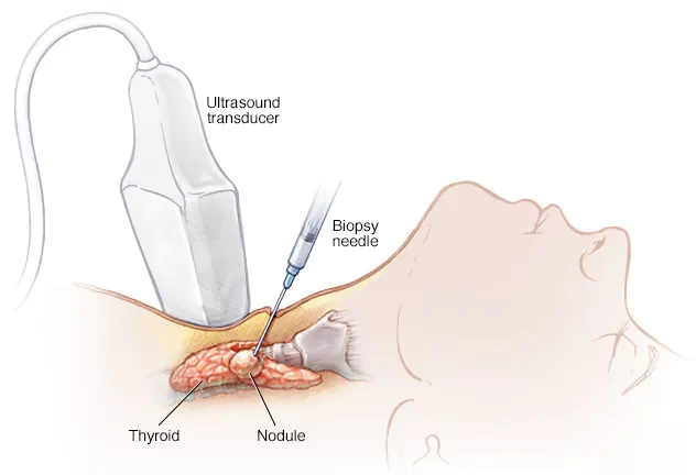 Scanova Imaging Center in Aurangabad, Dr. Sanket Sarda, Biopsy Services