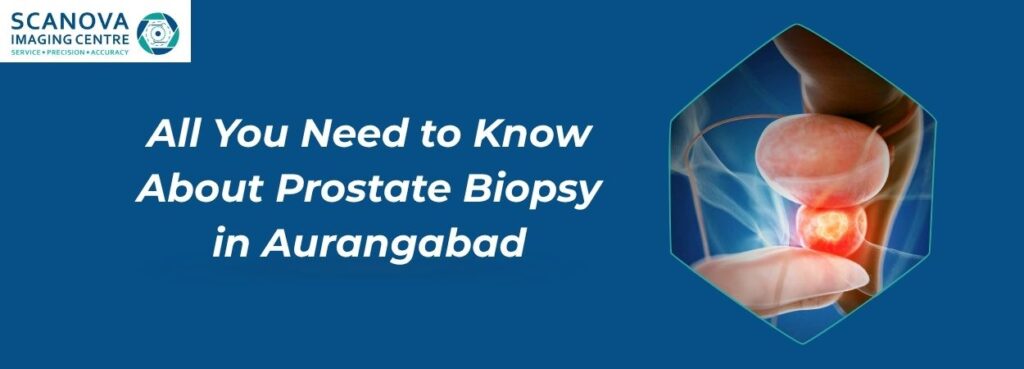 All You Need to Know About Prostate Biopsy in Aurangabad
